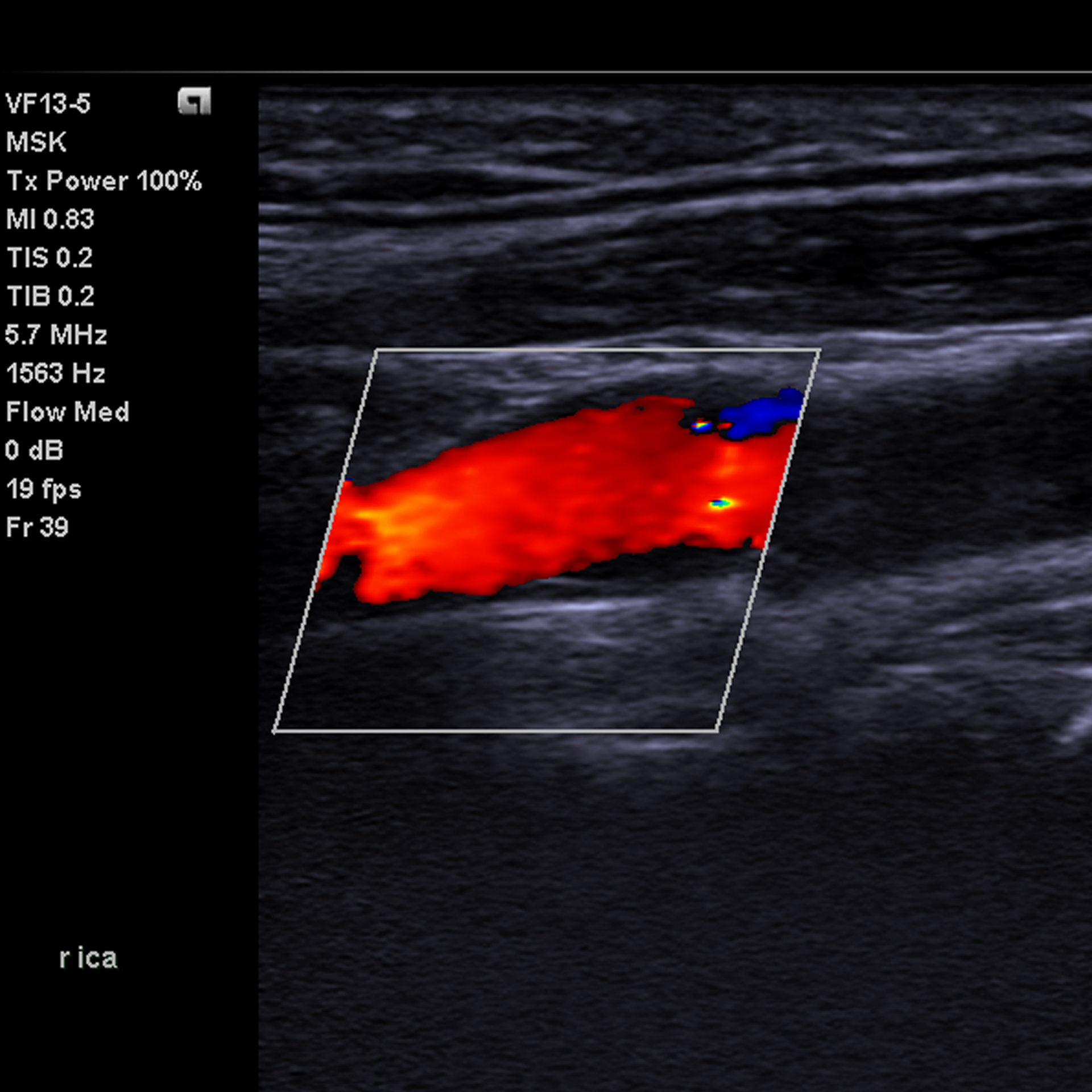 MSK Ultrasound