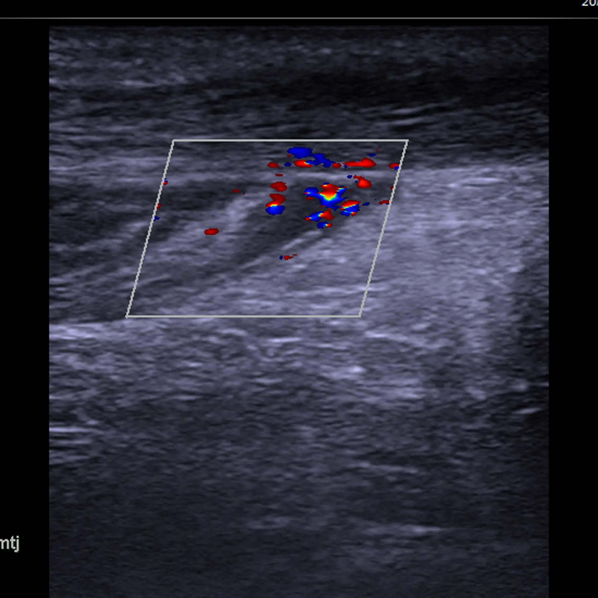 MSK Ultrasound