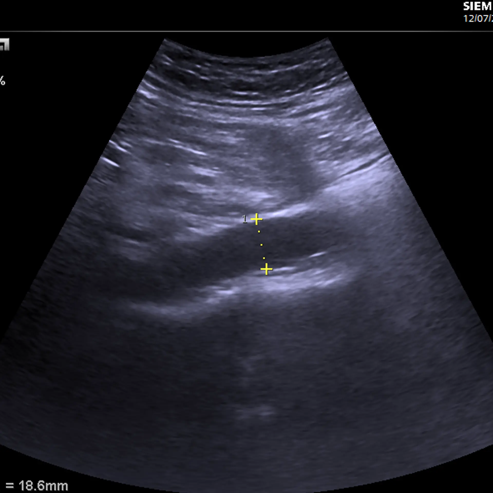 MSK Ultrasound