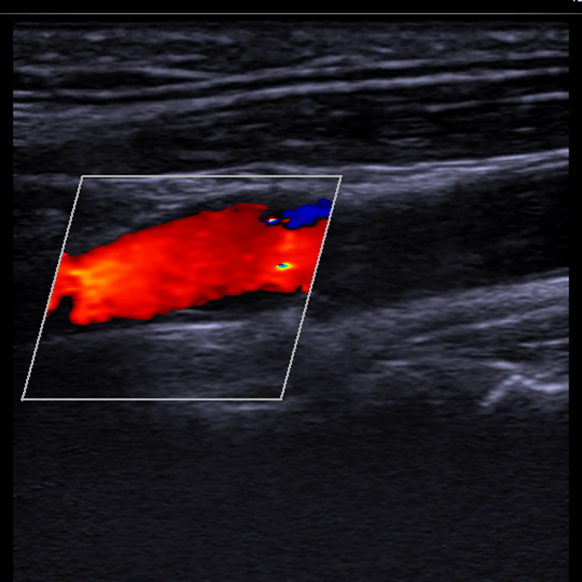 MSK Ultrasound