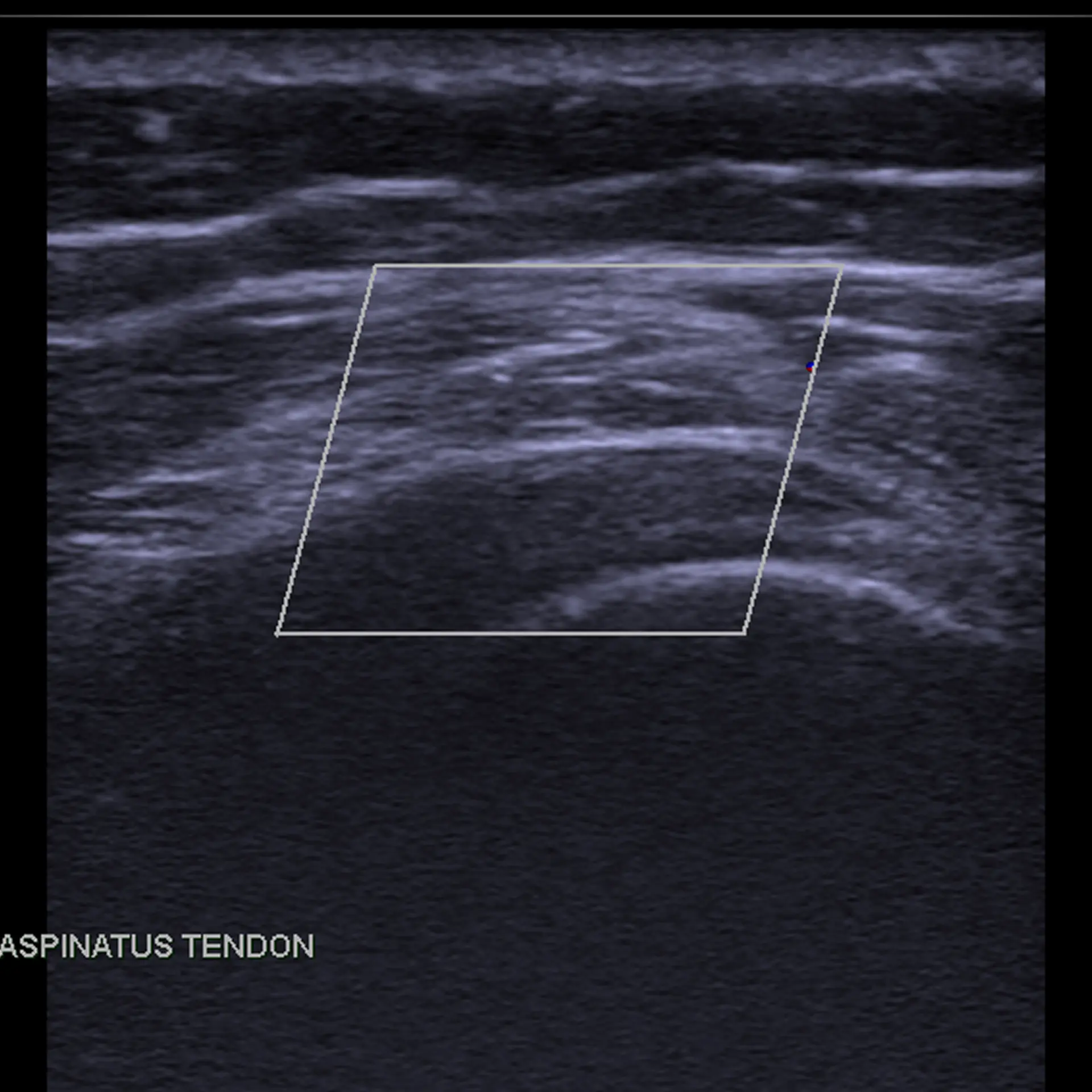 MSK Ultrasound